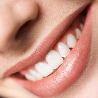 Solución Dental - Diseño de Sonrisa perfecto
